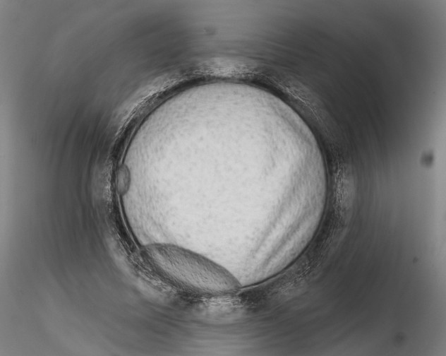 X0000114650587200912011114