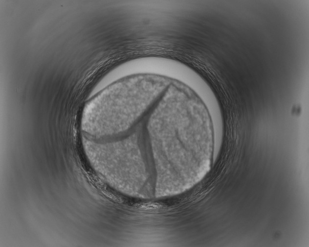 X0000114650599200912011114