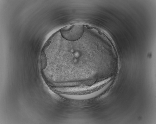 X0000114661149200911101337