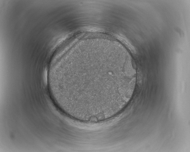 X0000114660014200911171120