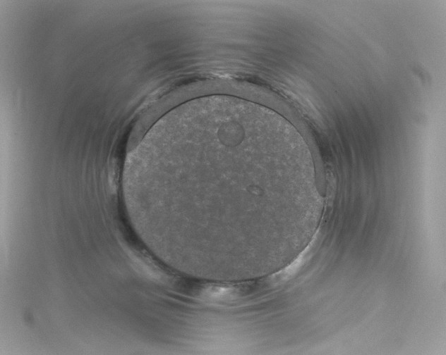 X0000114660174200911171118