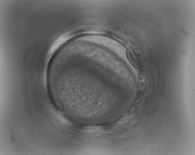 X0000114660296200911171116