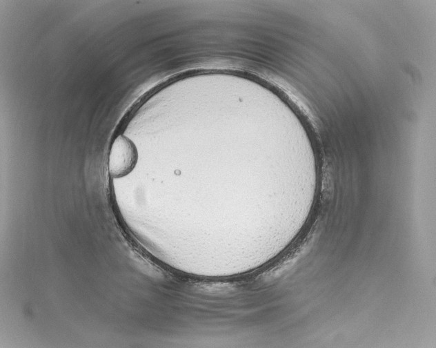 X0000114660837200911171109