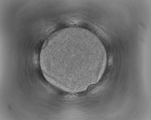 X0000114661156200911171105