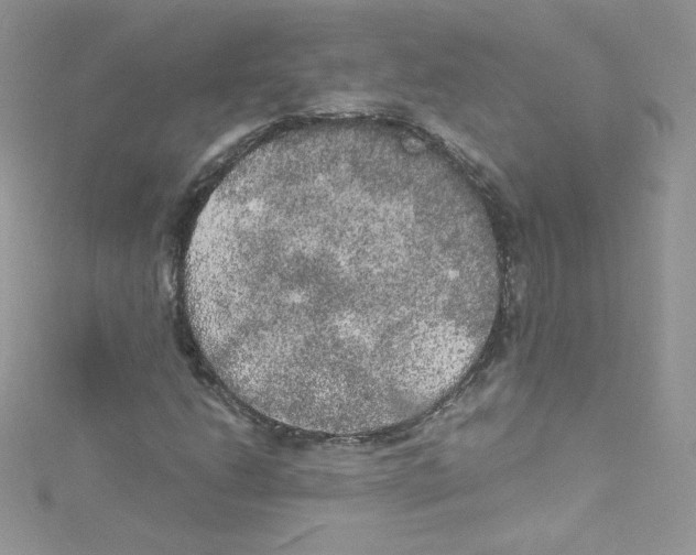 X0000114661206200911171104