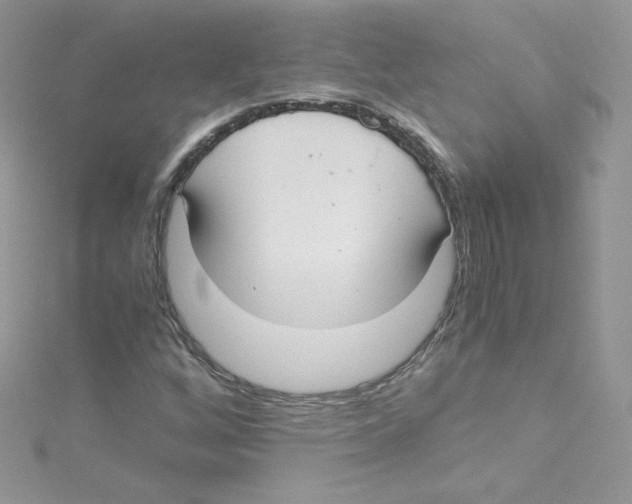 X0000114661256200911171104