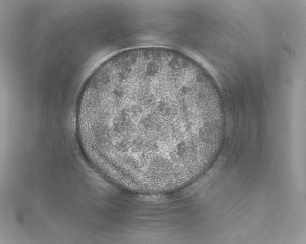 X0000114661415200911171101