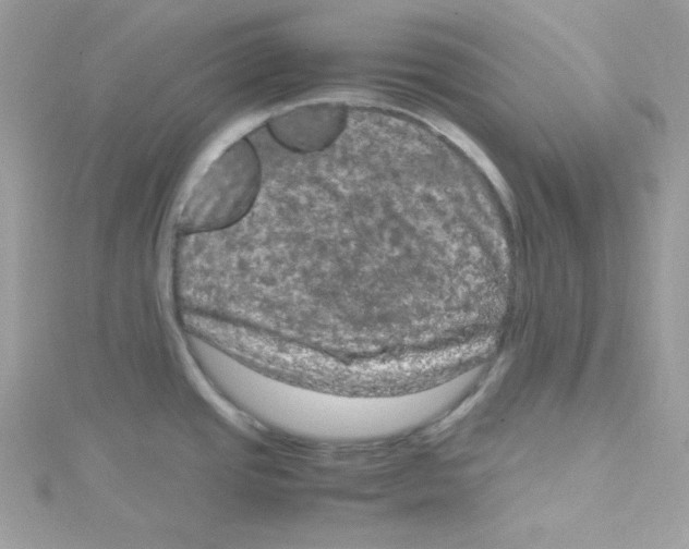 X0000114661437200911171102