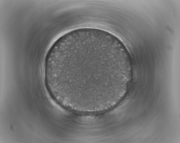 X0000114661515200911171100