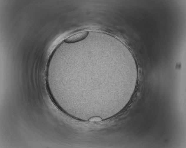 X0000114660007200912011146