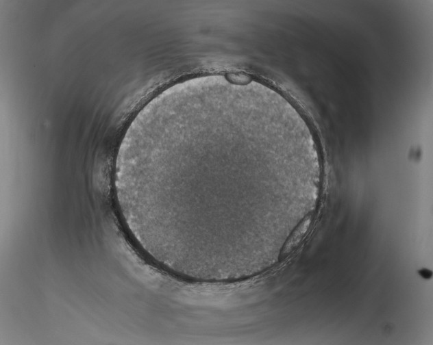 X0000114660009200912011146