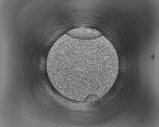 X0000114660036200912011146