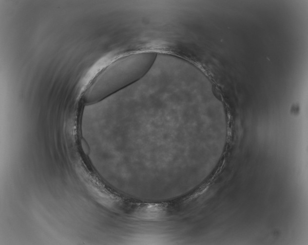 X0000114660056200912011145
