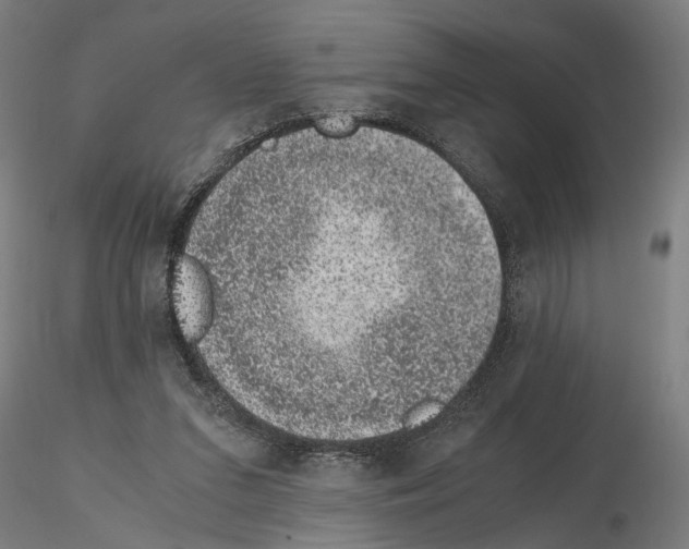 X0000114660207200912011143