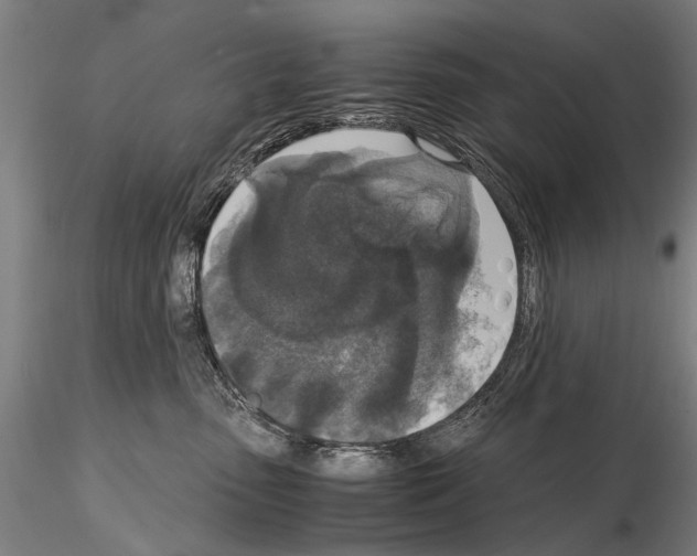 X0000114660475200912011139