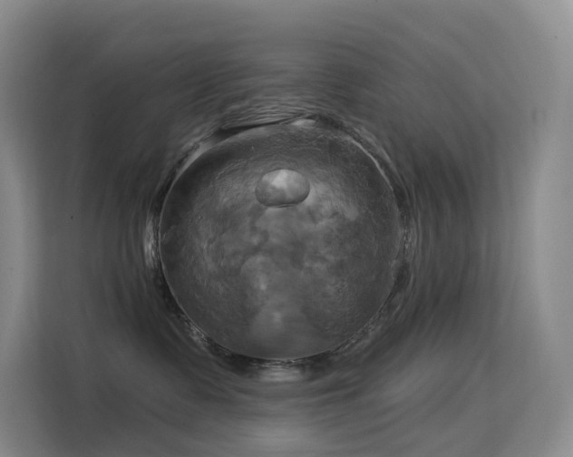 X0000114670335200910211155