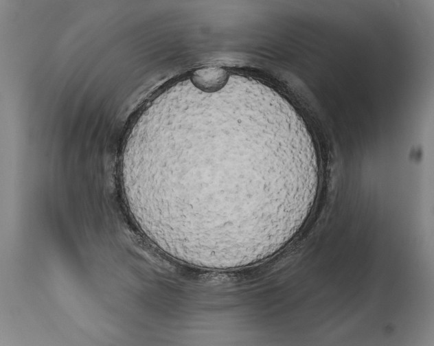 X0000114671217200911181159