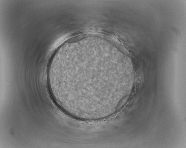 X0000114670005200912021104