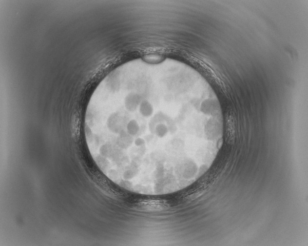 X0000114670499200912021057