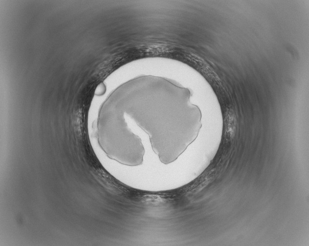 X0000114670519200912021056