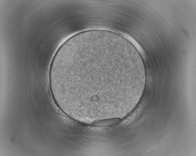 X0000114671004200912021049