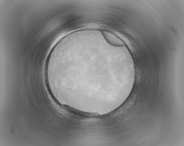 X0000114671475200912021043