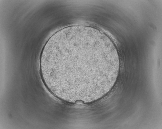 X0000114671479200912021043