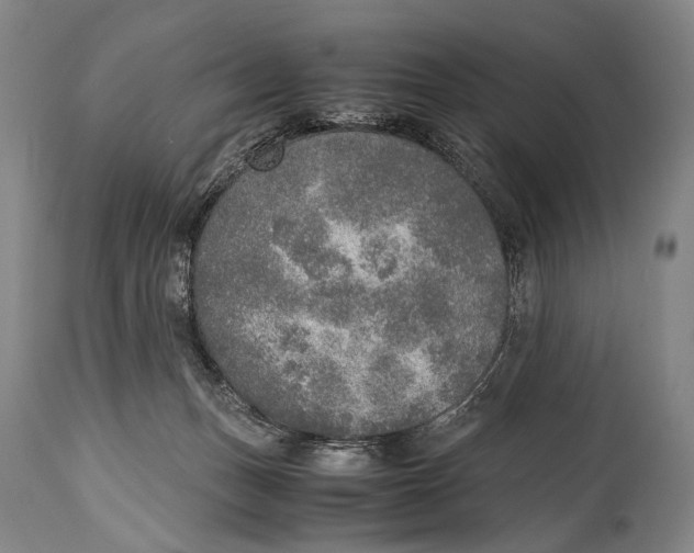 X0000114680175200911121504