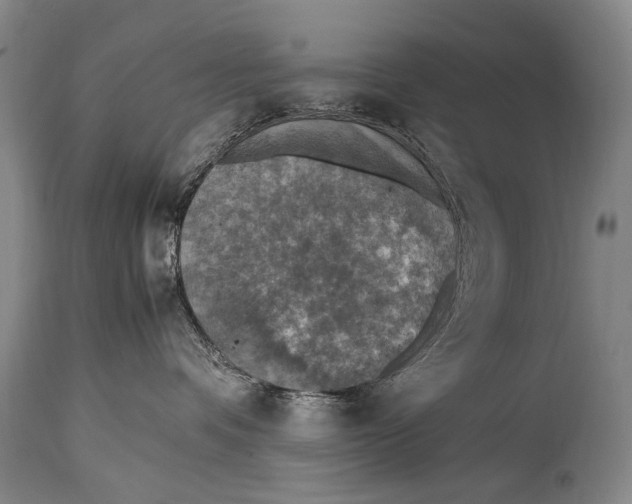 X0000114680336200911121501
