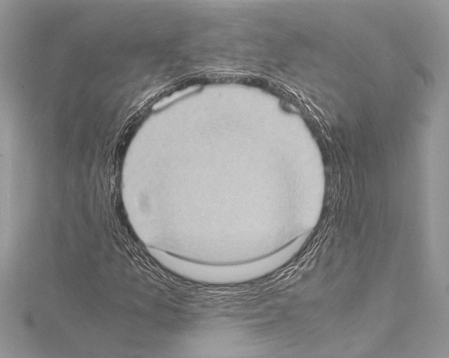 X0000114681157200912021109