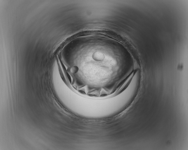 X0000114691449200911121508