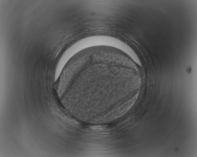 X0000114690516200912021048