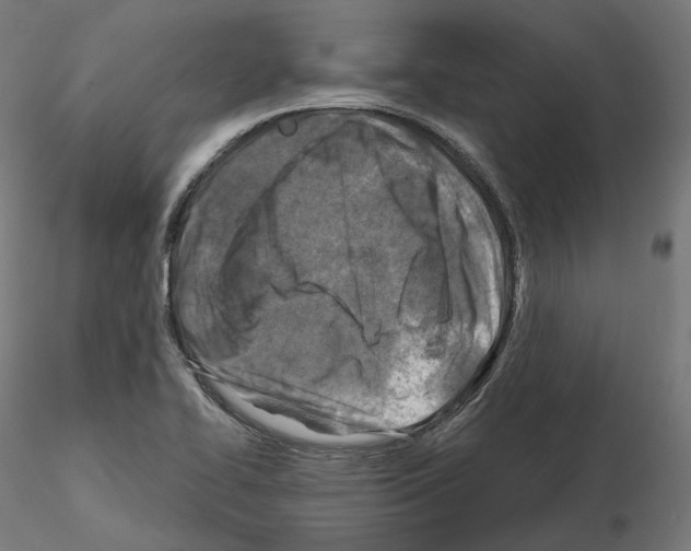 X0000114691414200912021034