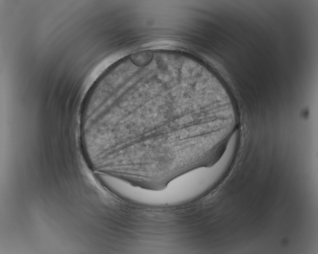 X0000114691418200912021034