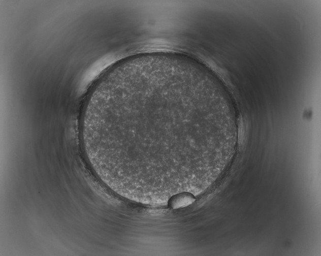 X0000114691453200912021034