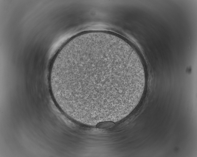 X0000114691464200912021033