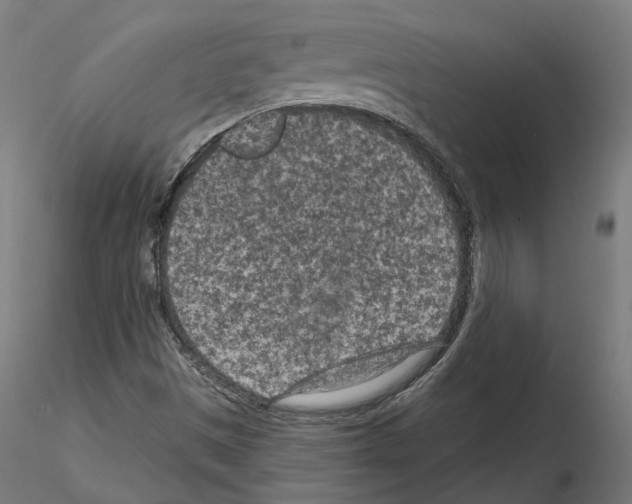 X0000114691497200912021032