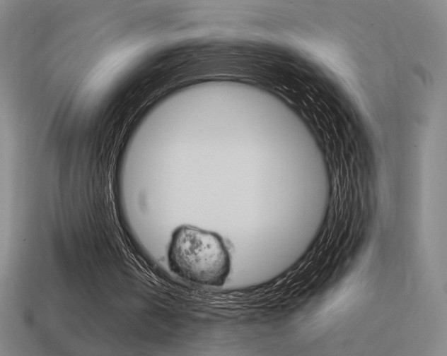 X0000114700146200910211017