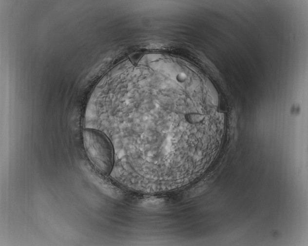 X0000114700257200911121546