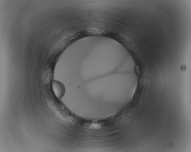 X0000114700647200911121541