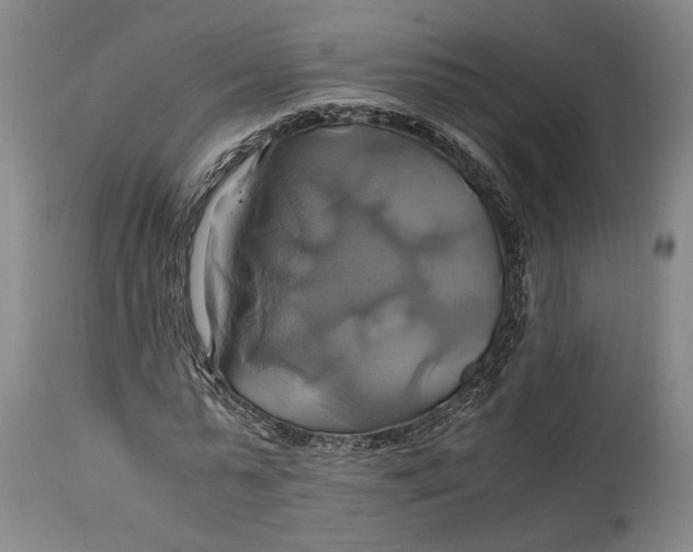 X0000114700775200911121539