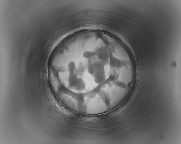 X0000114700837200911121538