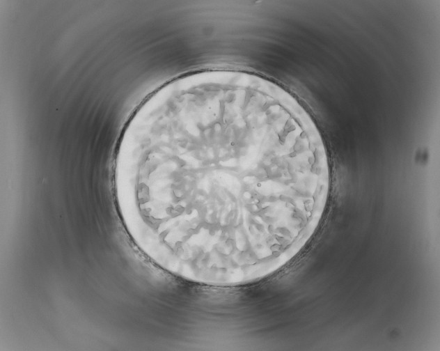 X0000114700856200911121539