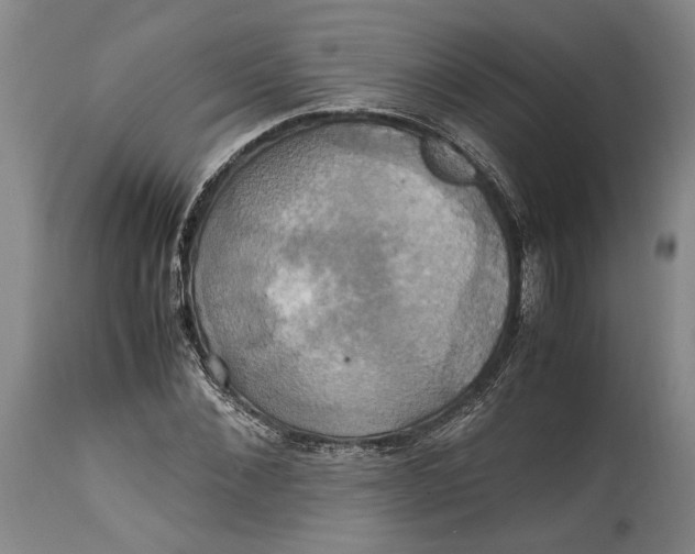 X0000114700876200911121538