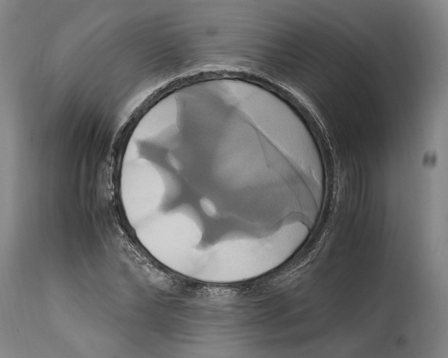 X0000114700878200911121538