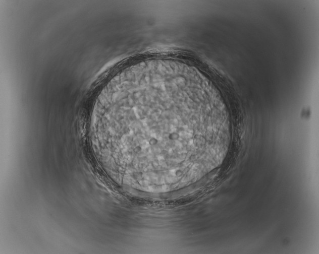 X0000114701206200911121532