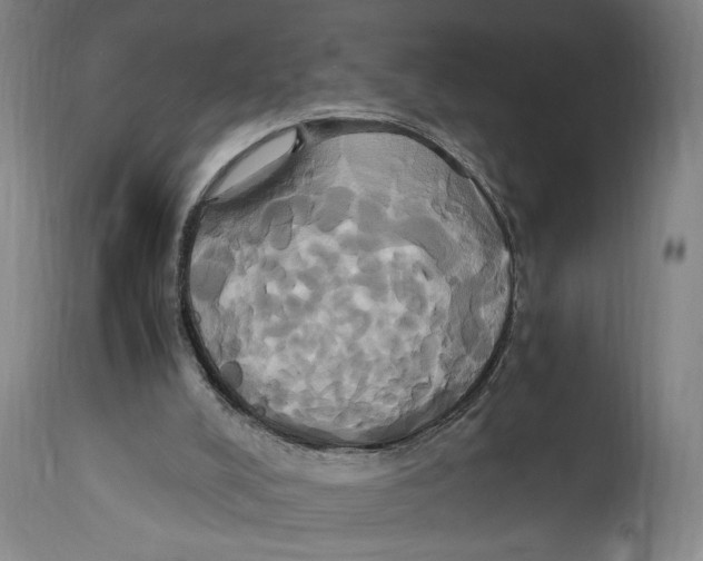 X0000114700008200911181328