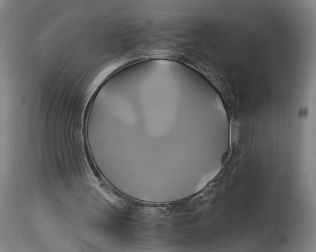 X0000114700147200911181325