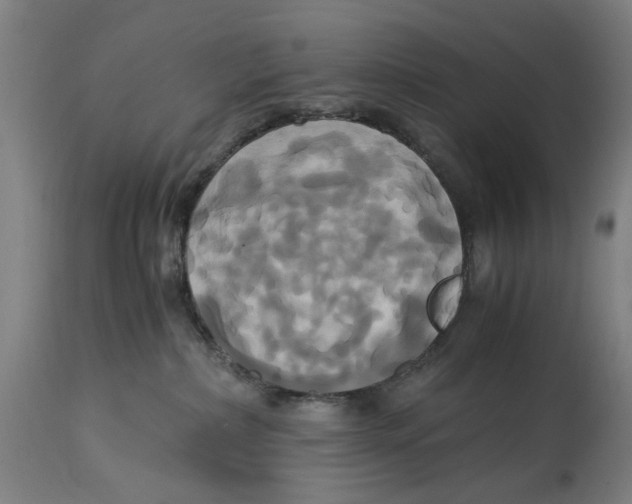 X0000114700236200911181325