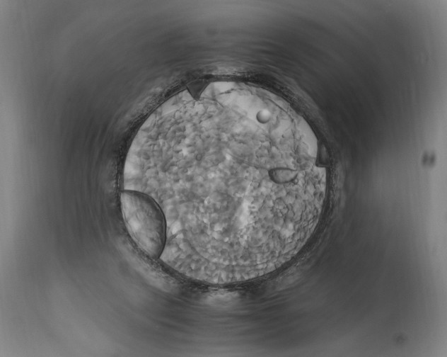 X0000114700257200911181324